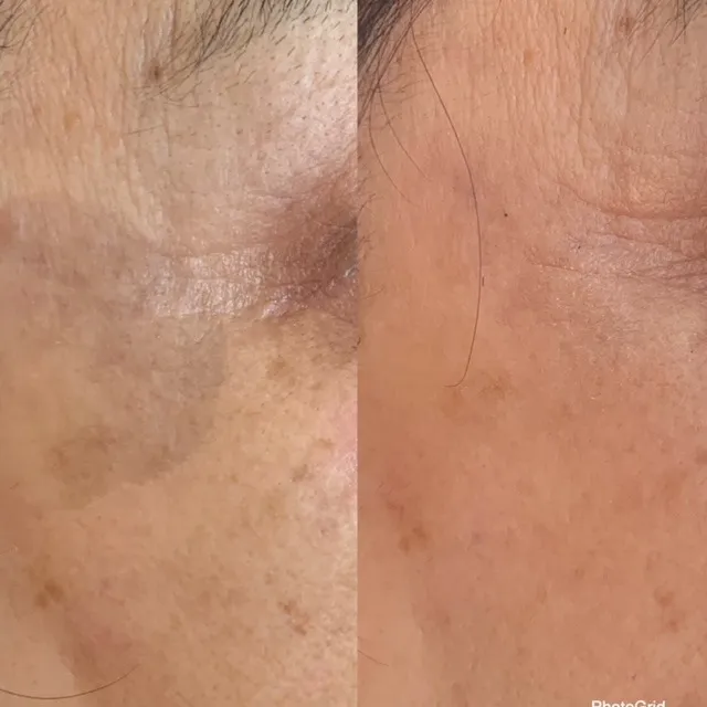 フェシヤルエステ